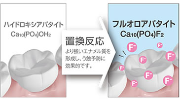 歯質にフッ素が取り込まれるイメージ